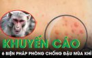 Khuyến cáo 6 biện pháp phòng bệnh Đậu mùa khỉ