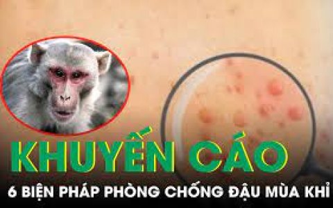 Khuyến cáo 6 biện pháp phòng bệnh Đậu mùa khỉ